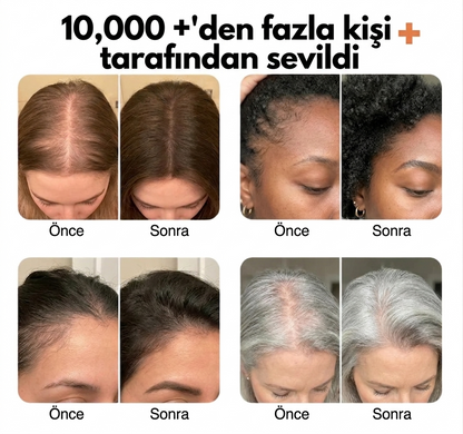 SAÇ BAKIM SERUMU